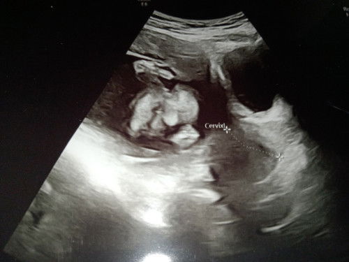 แบบนี้ผู้หญิงแน่ใช่ไหมคะ