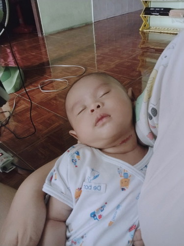 คอน้องเป็นแผลแนะนำยาทาหน่อยค่ะ