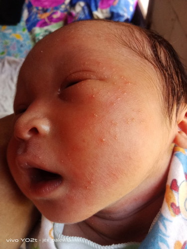 Obat buat kulit gini apa ya bun kemarin lahiran gak ada bruntus an gini sekarang ada