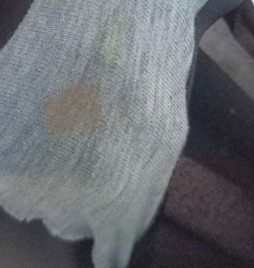 Discharge po ba ito?