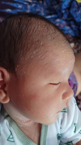 Alhamdulillah anak kdua hpl 15 nov, lahir 9 nov baby boy. Info dong bun?ada yg sma gk dn gmna ya?