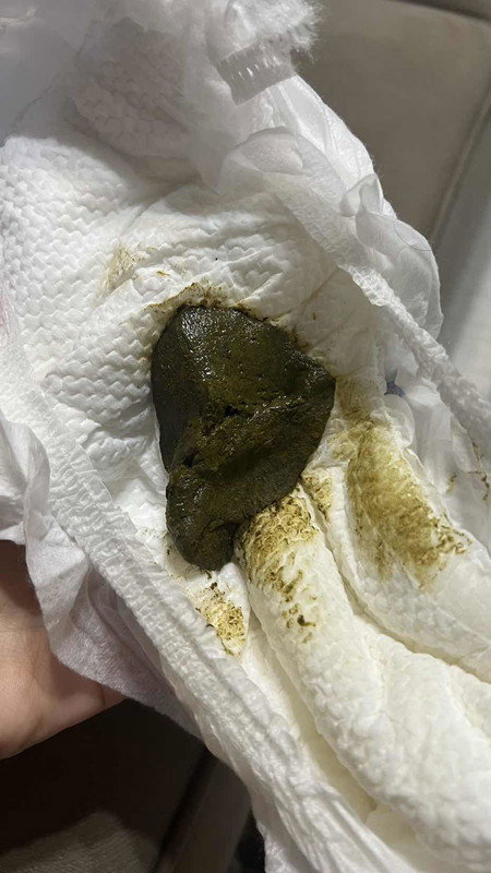 Warna BAB gelap hijau tua ke hitam