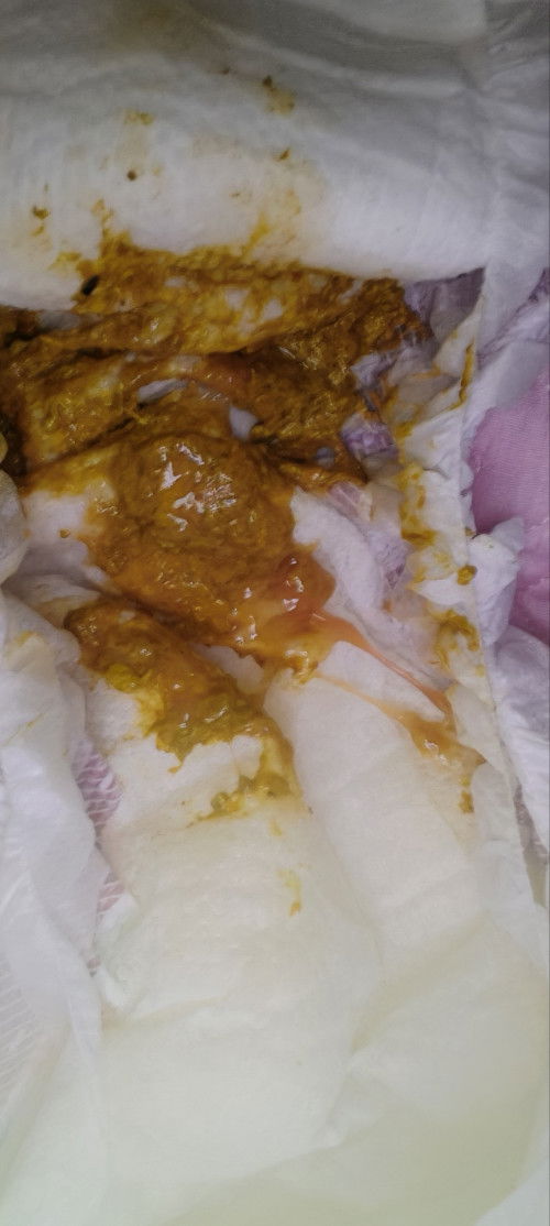 Amoeba po ba to? wag naman sana :(