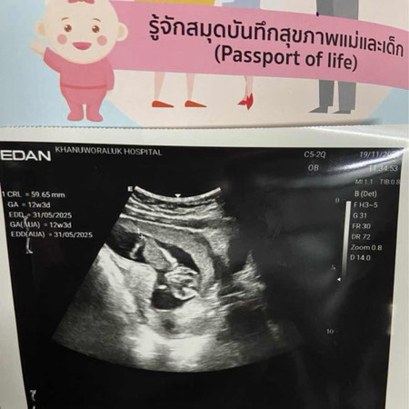 ท้องแรกค่ะ 12วีค