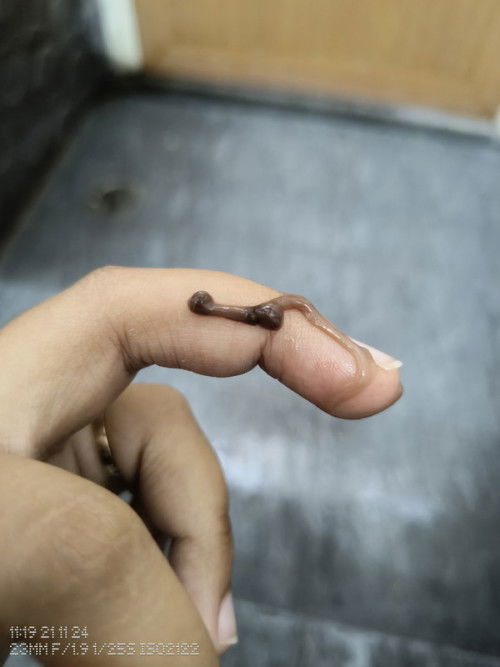 Spotting atau bukan?
#maaf gambar kurang menyenangkan