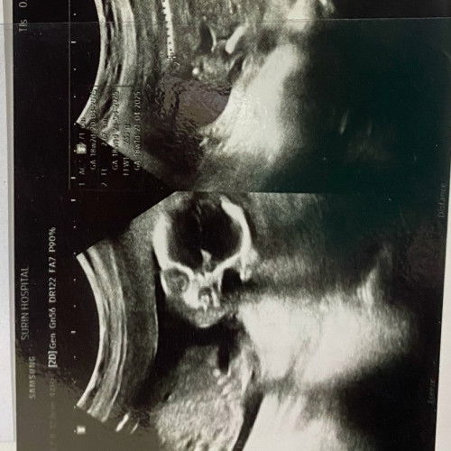 สอบถามเพศลูก