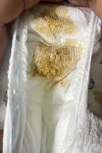 ลูกถ่ายแบบนี้ปกติไหมคะ