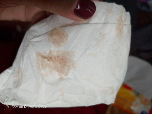 Hamil 15 week keluar cairan warna cokelat, bahaya ??