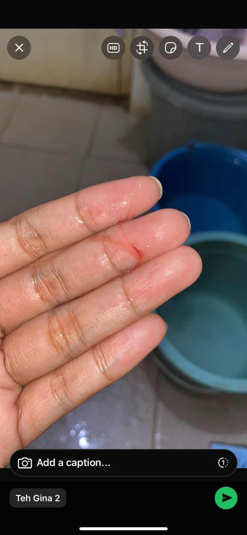 Haid lancar lagi gimana caranya?