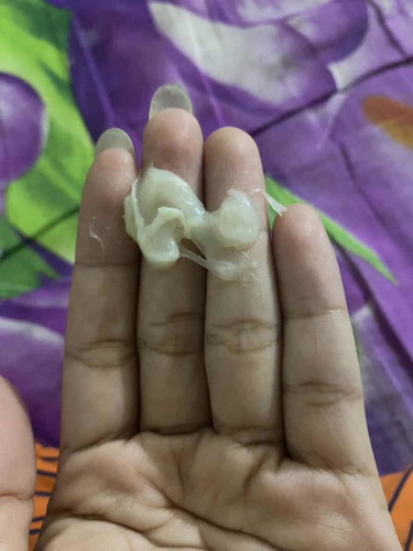 มีมูกคล้ายขี้มูกเหนียวๆออกมาอันตรายไหมคะ