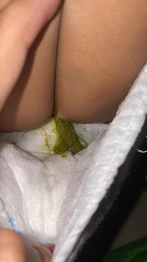 batita 16 bulan pup hijau