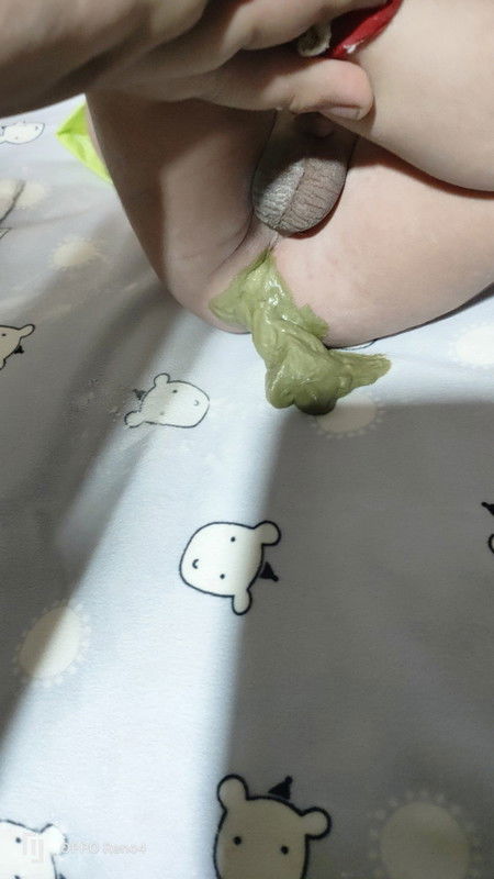 ถ่ายสีเขียว