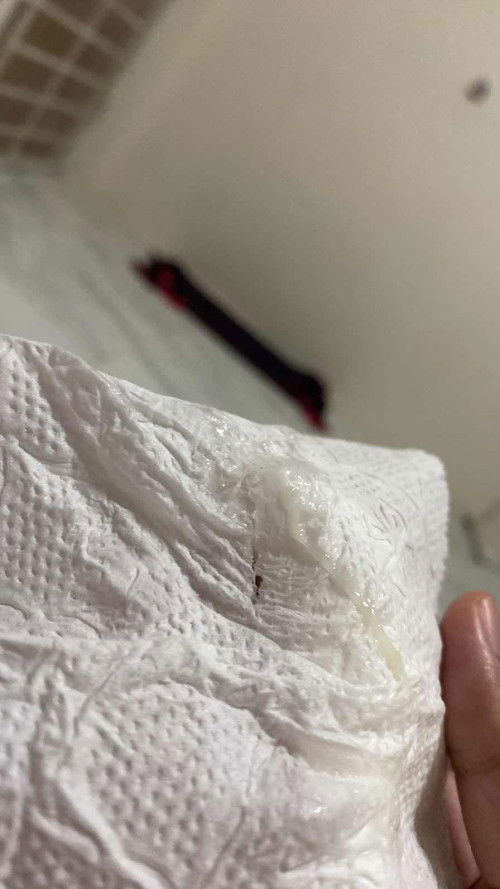 แบบนี้มูกใกล้คลอดหรือตกขาวคะ 🙏