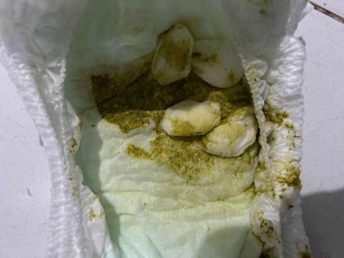 Apakah ini diare Bun.