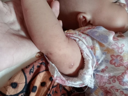 bun mau tanya ini anak aku kenapa ya, alergi atau apa , cara mengobatinya gimana,??