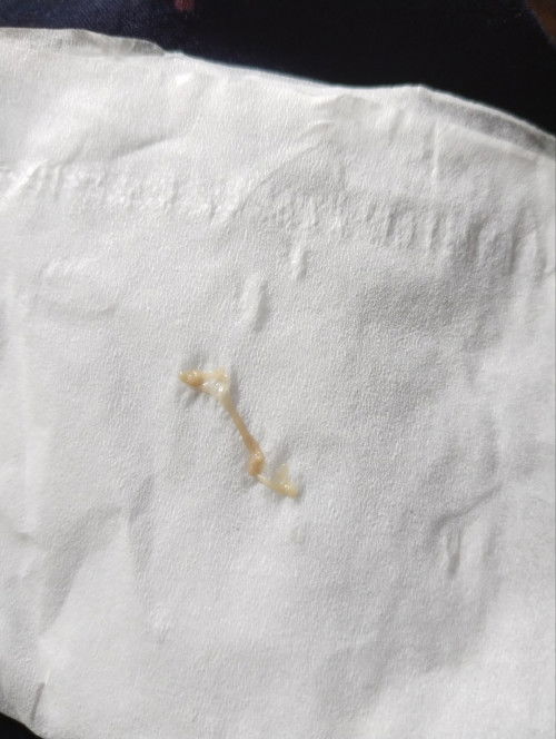 Keputihan atau apa ya bund