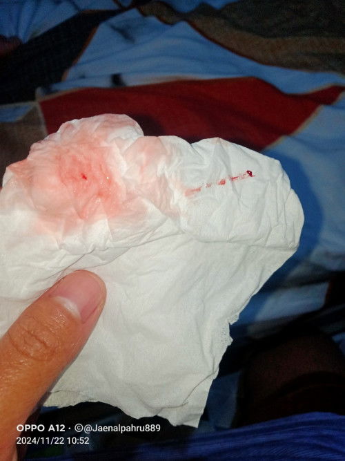 Mau tanya dong bunda²