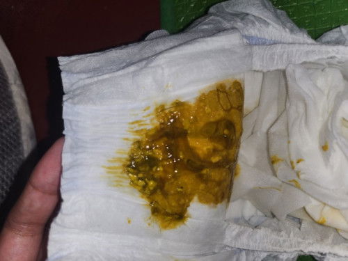 Greeny stool with mucus