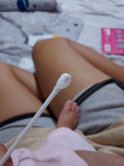 Hi mommies👋 FTM here may nakuha po akong ganito sa LO ko Marami may sipon na po ba sya?