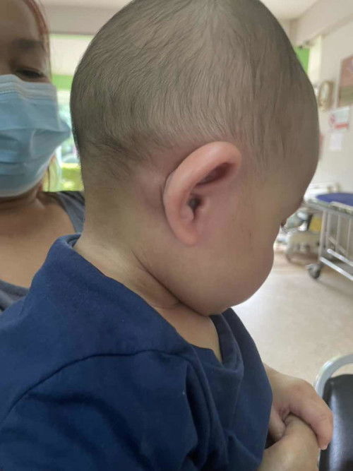 ลูกบ้านนี้แพ้cerelacค่ะ บ้านไหนแพ้บ้างคะ