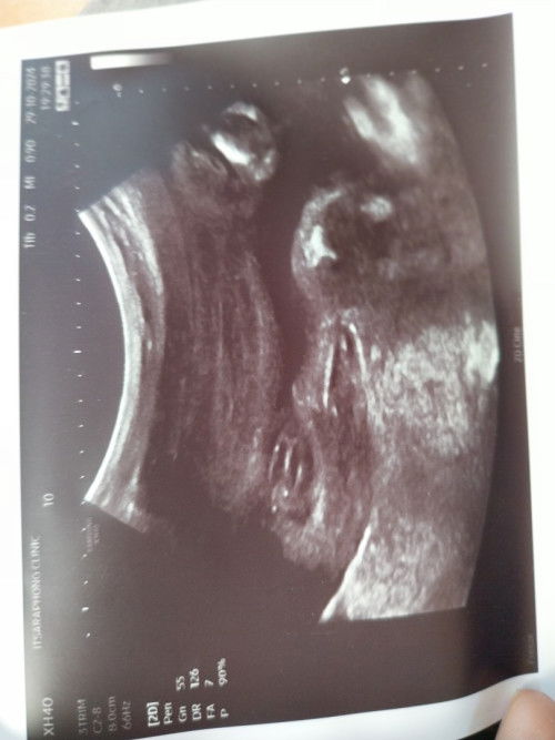 ผู้หญิงหรือผู้ชายคะ ช่วยดูหน่อยค่ะ