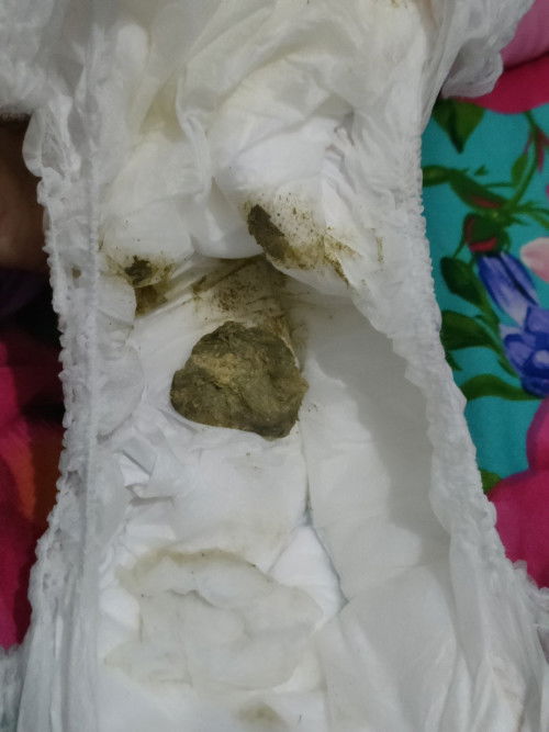 Pup !! TW!! Kotoran bayi