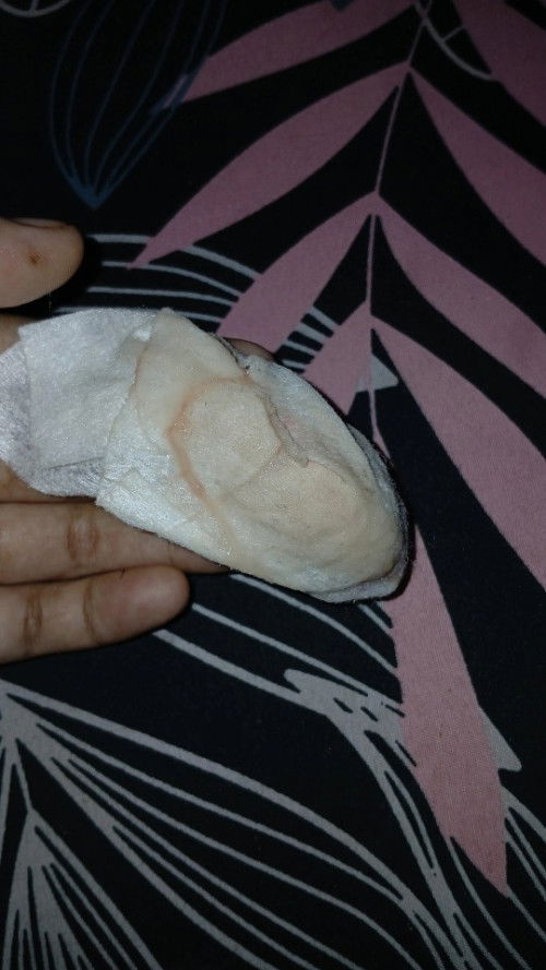 Assalamualaikum bun maaf mau tanya, UK saya skrng 38w 4d, kemaren kemaren sempet konpal malam ini ke