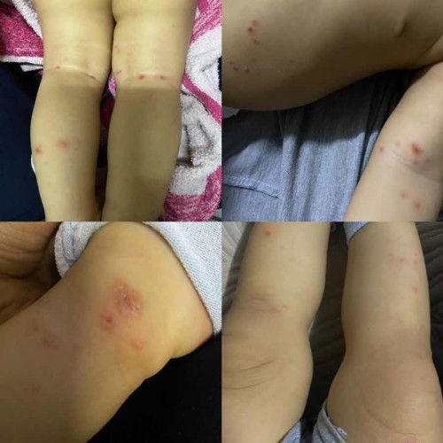 Anak kene bakteria dari kucing