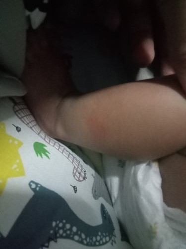 แอบกังวลลล🥺