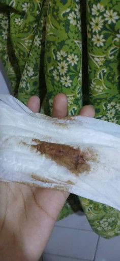 Mau tanyaa kepada yg berpengalaman kalau selepas minum air kelapa saya ada keluar warna bgini