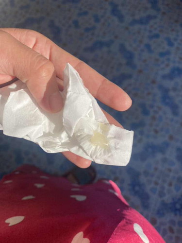 ท้อง36+6 ท้องเเรก