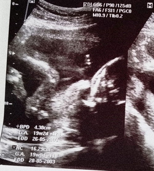 ขอสอบถามแม่ๆหน่อยค่ะ