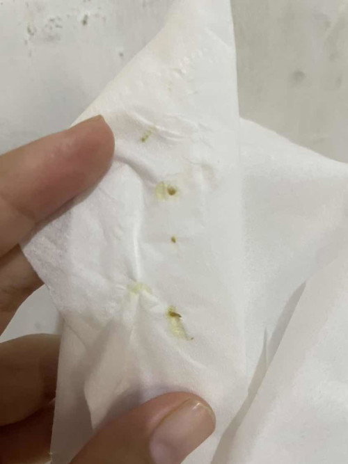 Kotoran telinga bayi 2 bln