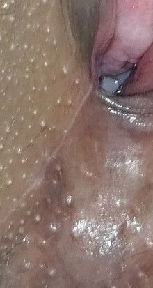 Hello ask ko lang bumuka poba ang tahi kapag ganito