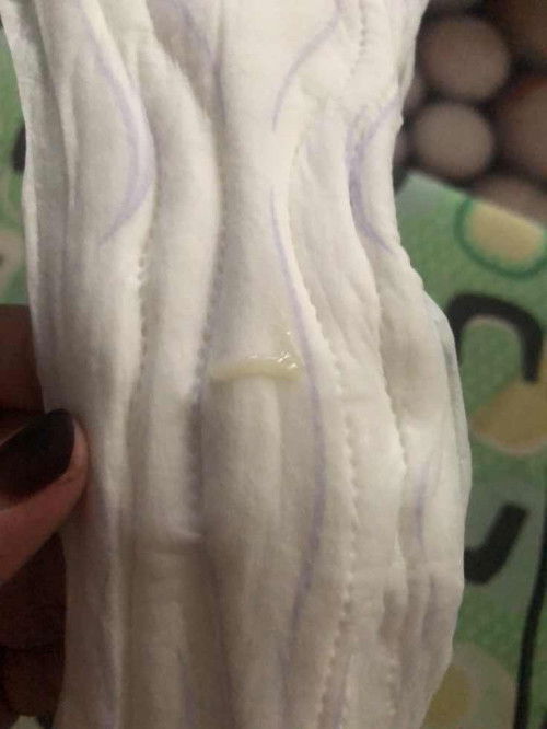 keputihan tnda hamil