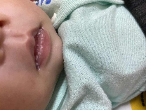 Minum susu formula tapi lekat dekat bibir