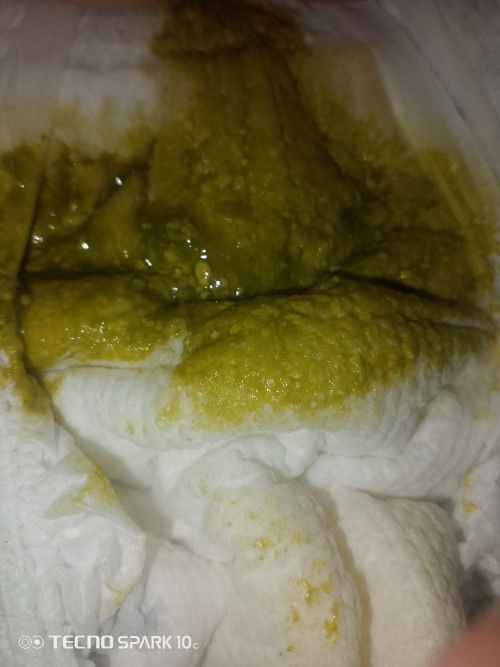 normal lang po ba Ang ganitong kulay ng poop ni baby ?