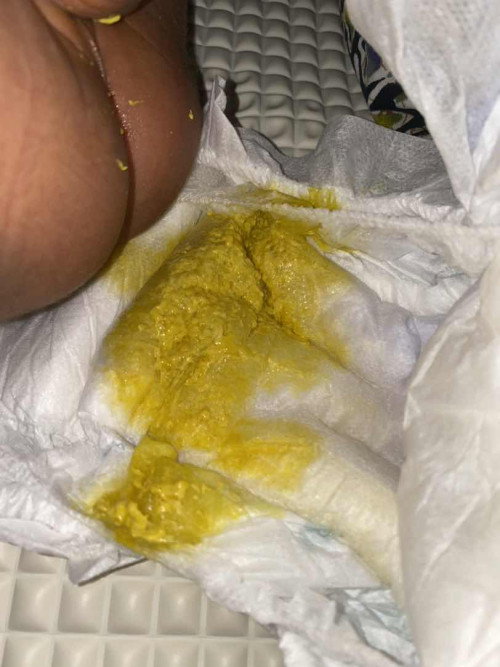 Bayi 1 bulan 20 hari. Normal ke najis bayi sampai skrg texture mcmni? Baby fully FM.