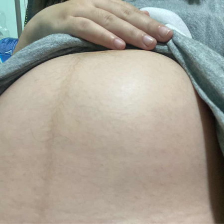 แบบนี้คือน้องโก่งตัวใช่ไหมคะ