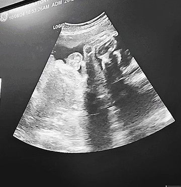 MGA mhie Ano Po sa tingin nyo Ang gender ni baby??