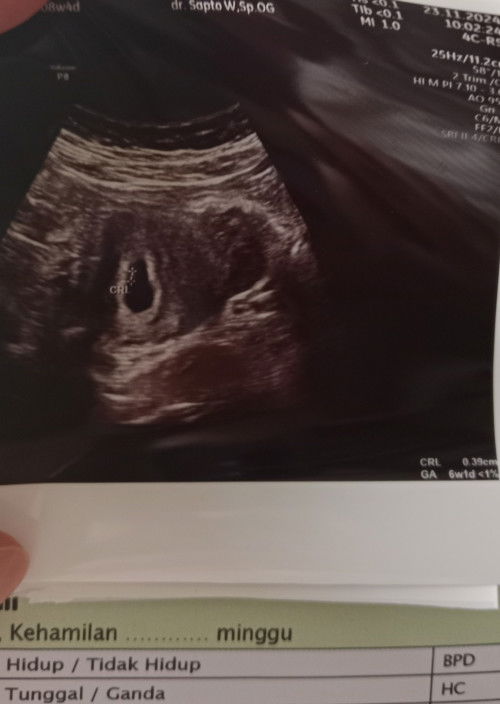 Hasil USG tidak sesuai