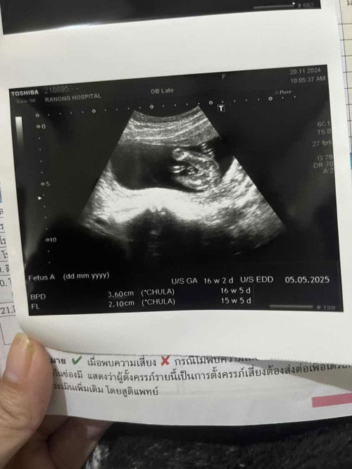 สอบถามแม่ๆหน่อยค่ะ