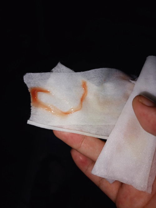 Normal po ba to na may lumalabas ng ganyan after e IE?  2cm na din kase ako tuloy tuloy na po ba to?