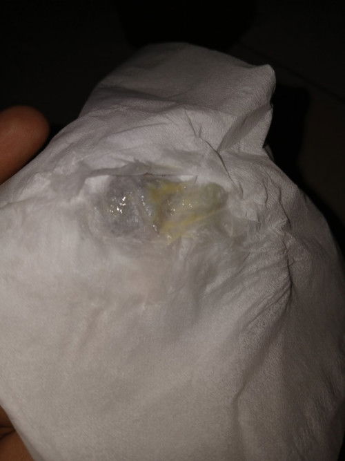 Keputihan kuning encer bau tpi tdk gatal knp ya bun ada yg sama gak? Aku lahiran normal