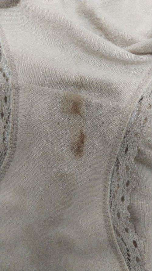 Spotting 8 Weeks [Now dah 13 Weeks]