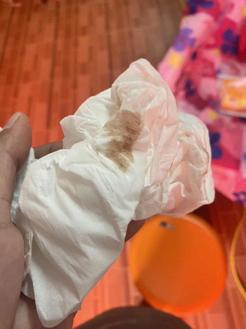 มีเลือดออก ยังไม่ฝากครรภ์ ไปพบหมอแล้ว