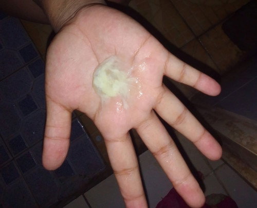 Keluar cairan di 37 week