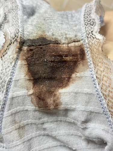 ท้อง12week.อยู่ดีๆวันนี้มีมูกแบบนี้