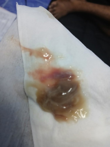 37+6มีหมูกแบบนี้ออกค่ะ