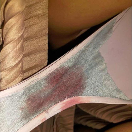 Hamil 4 minggu, tespek garis 2, tiba2 keluar darah. Aman gak ya?